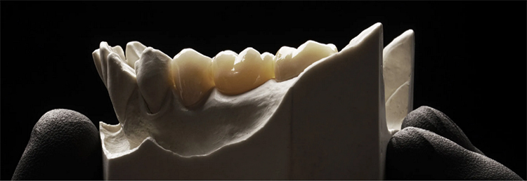 ACM01 ST WHITE block